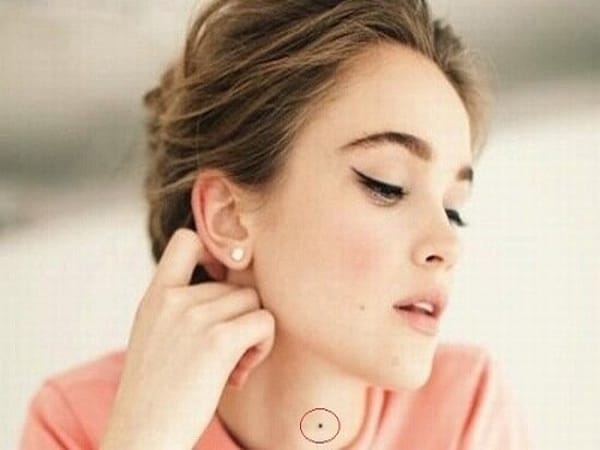 Nốt ruồi ở cổ nữ giới
