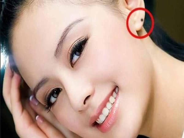 Nốt ruồi ở tai có ý nghĩa gì theo nhân tướng học