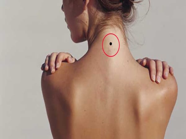 Luận tình duyên vận số người có nốt ruồi sau gáy