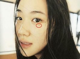 Ý nghĩa nốt ruồi lệ điềm gở hay dấu hiệu vận mệnh đặc biệt