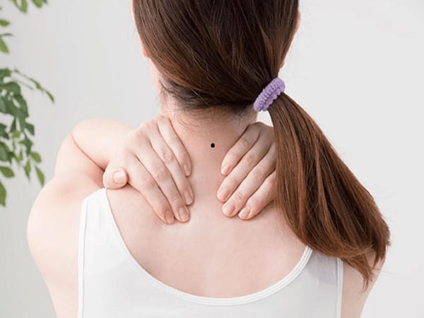 Nốt ruồi sau gáy có ý nghĩa gì