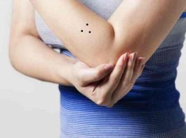 3 nốt ruồi hình tam giác