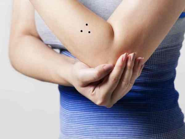 Ý nghĩa 3 nốt ruồi hình tam giác là gì?