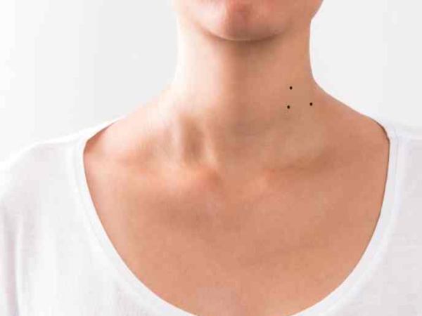 3 nốt ruồi hình tam giác ở cổ