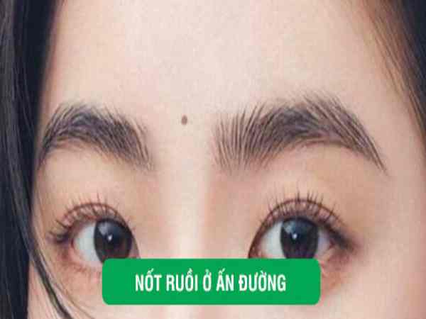 Mụn ruồi nằm ở ấn đường giữa hai chân mày