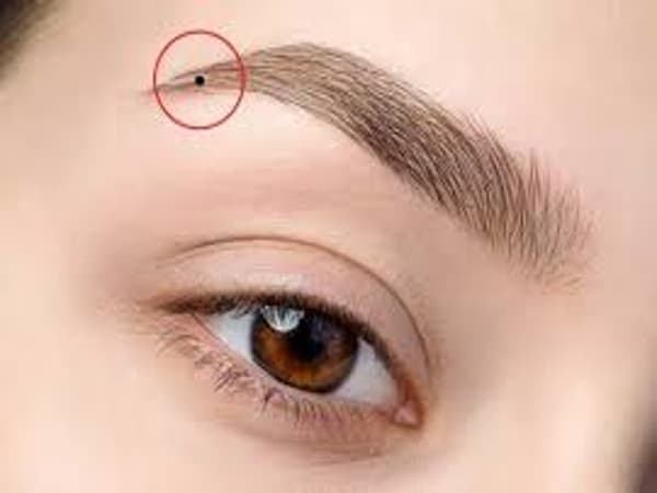 Nốt ruồi ở đuôi chân mày