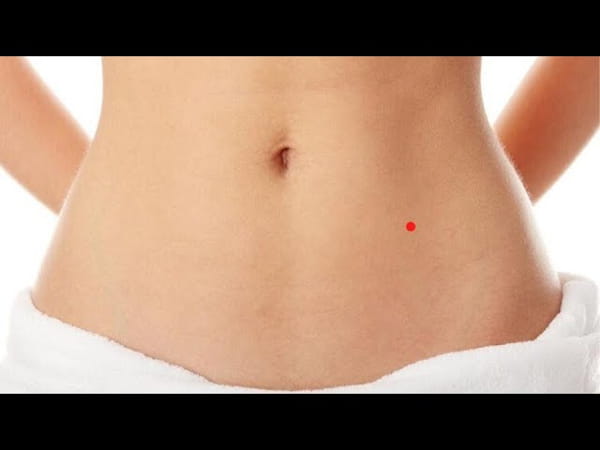 Nốt ruồi son ở bụng nói lên điều gì?