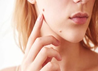 Ý nghĩa nốt ruồi bên má nói gì về tính cách, tình duyên
