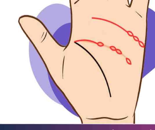 đường chỉ tay mắt xích