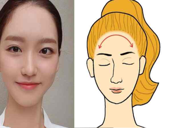 Trán tròn là gì?  Trán tròn là gì?