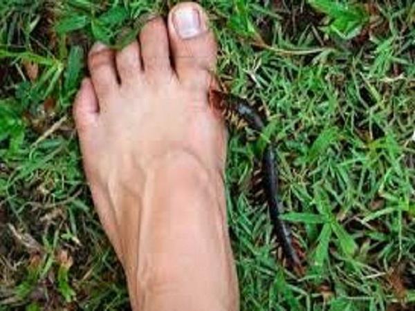 Giải mã chi tiết các giấc mơ thấy rết cắn